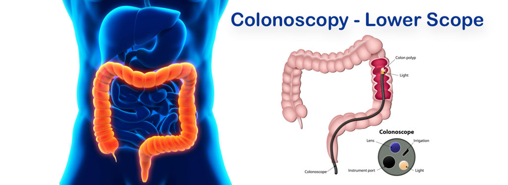 Colnscopy Pediatric Gastroenterologist