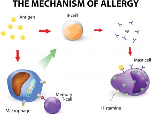 Mechanism-of-allergy