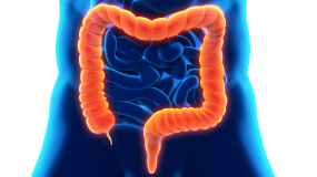 IBD is crohns and colitis