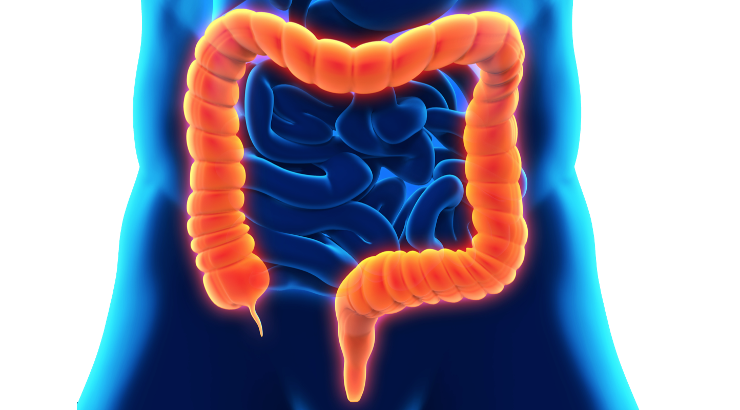 Inflammatory Bowel Disease Over The Counter