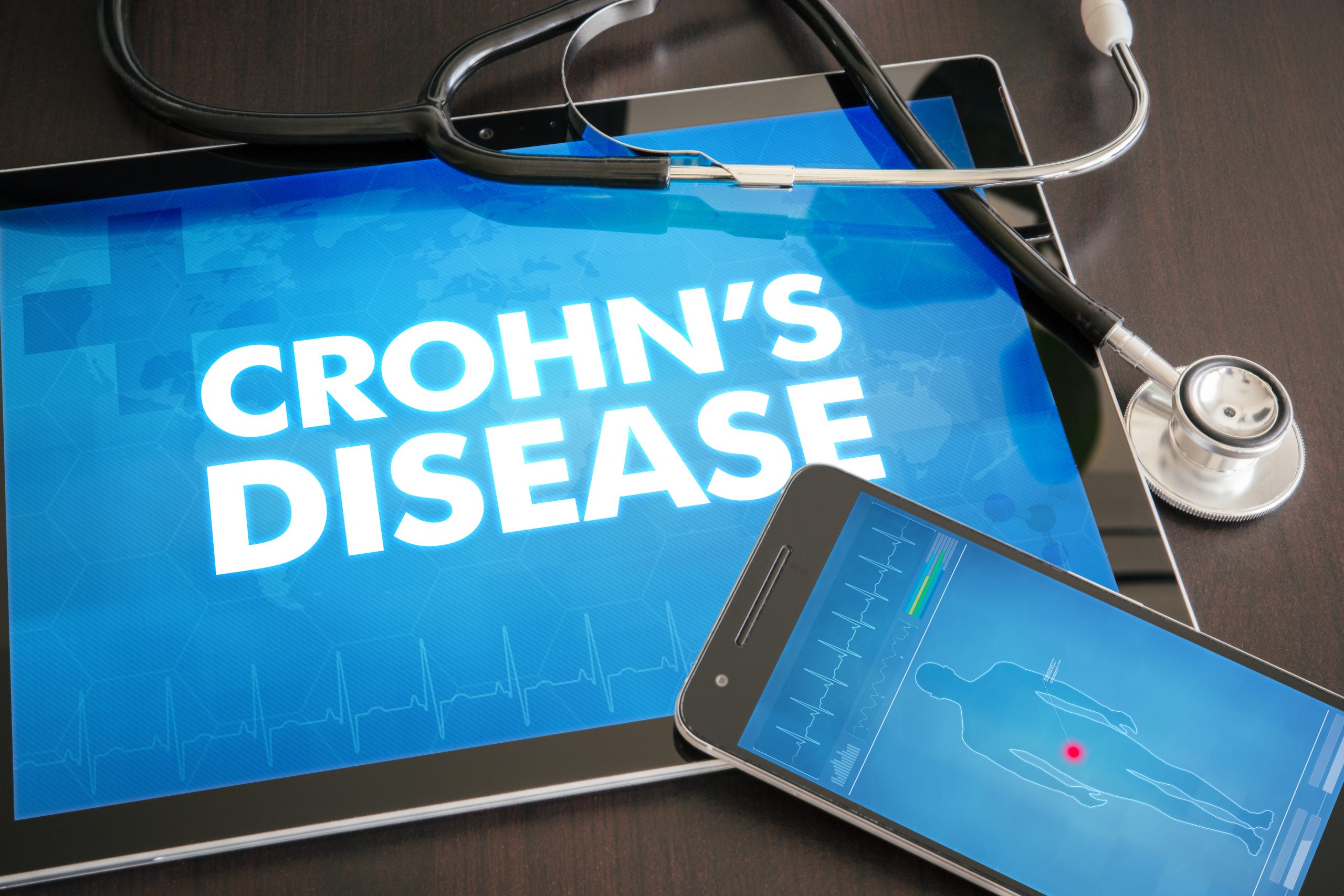 Crohn's Disease Inflammatory Bowel Disease